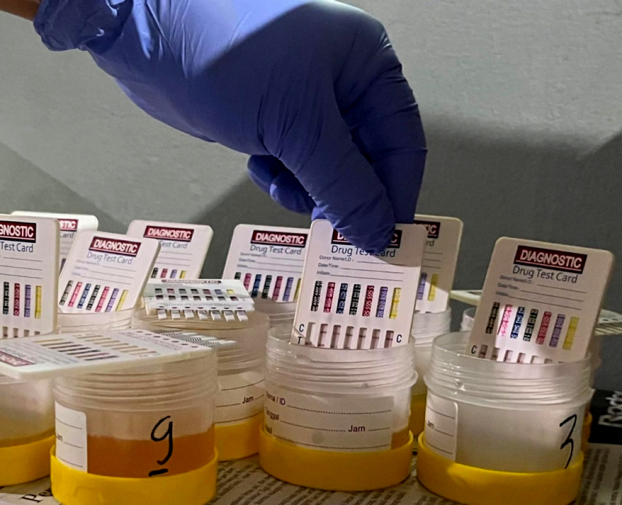 Ilustrasi hasil tes narkoba. Foto : ist